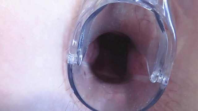 MILF With a Fat Ass Gets Her Shitters Stretched Wide Open With a Gyno Speculum, Gaping Asshole and Pussy on Display