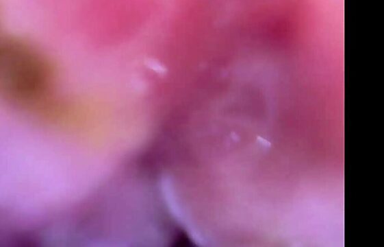 Siime Eye Explores My Amateur Anal After Enema