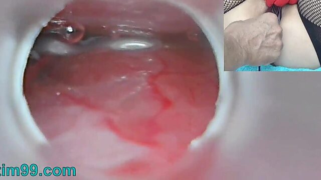 Raw Asian Creampie and Womb Cam Insemination